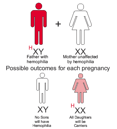 Hemophilia 1